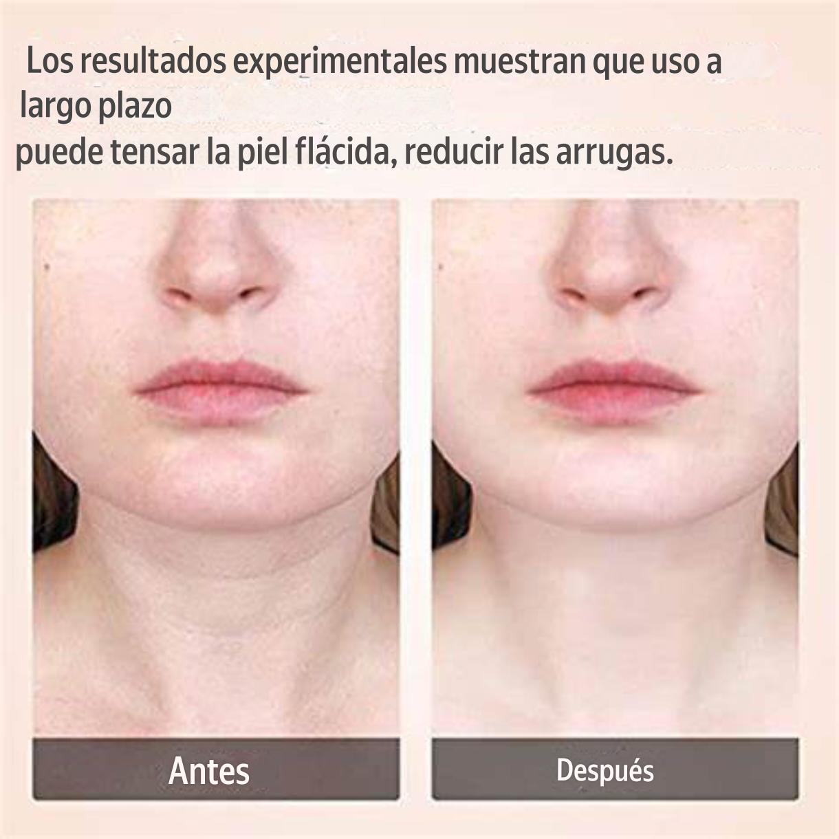 Tonificador Facial 3 en 1