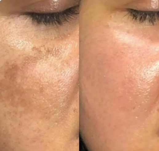 Arbutina Magic Skin – Crema Arbutin White