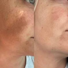 Arbutina Magic Skin – Crema Arbutin White